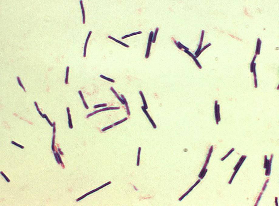 Bahaya Makan Ayam Mentah, Penuh Bakteri!